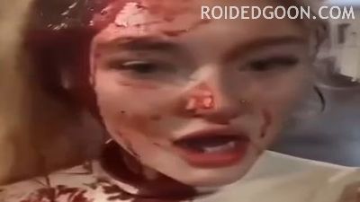 Girl Left Extremely Bloodied After Fight